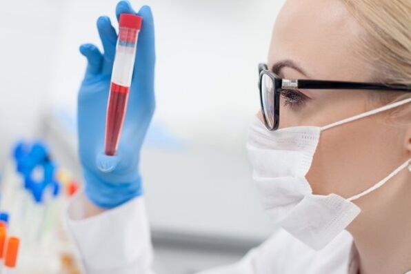 blood test for hypertension